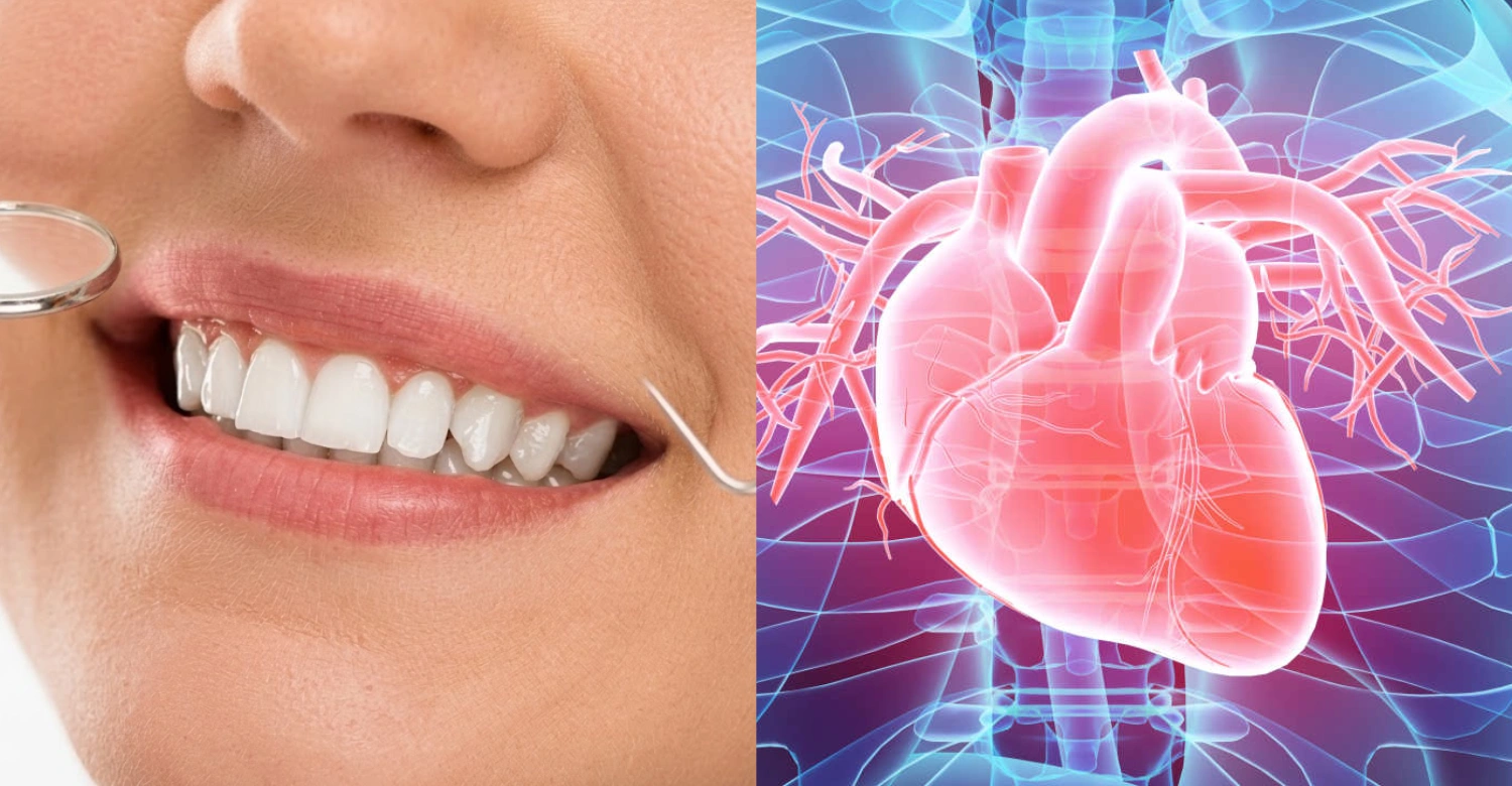 Cardiometabolic Disease and Oral Health inblog